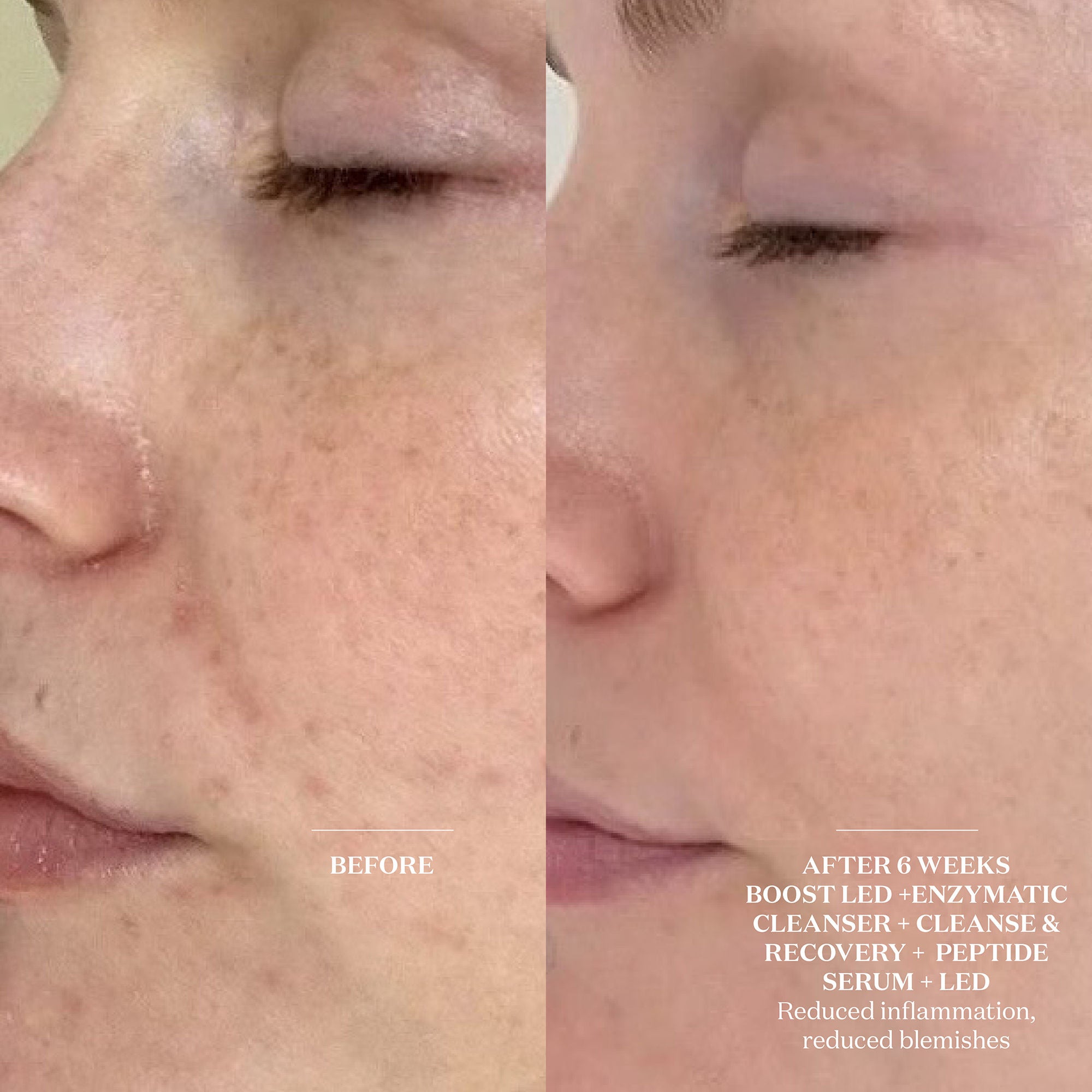 Cleanse & Recovery Spray - Detoxifying Facial Mist for Skin Refresh & Hydration | Perfect for Post-Workout, Travel & Daily Skincare Routine