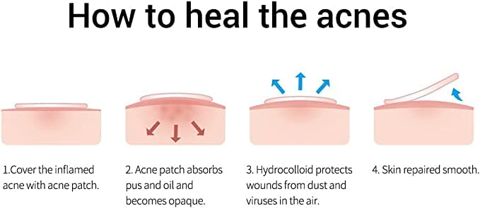 108 Hydrocolloid Skin Tag Removal Patches - Top-Grade Pimple & Skin Tag Treatment - Covers & Conceals Blemishes - Perfect for Face, Body & Sensitive Skin Care