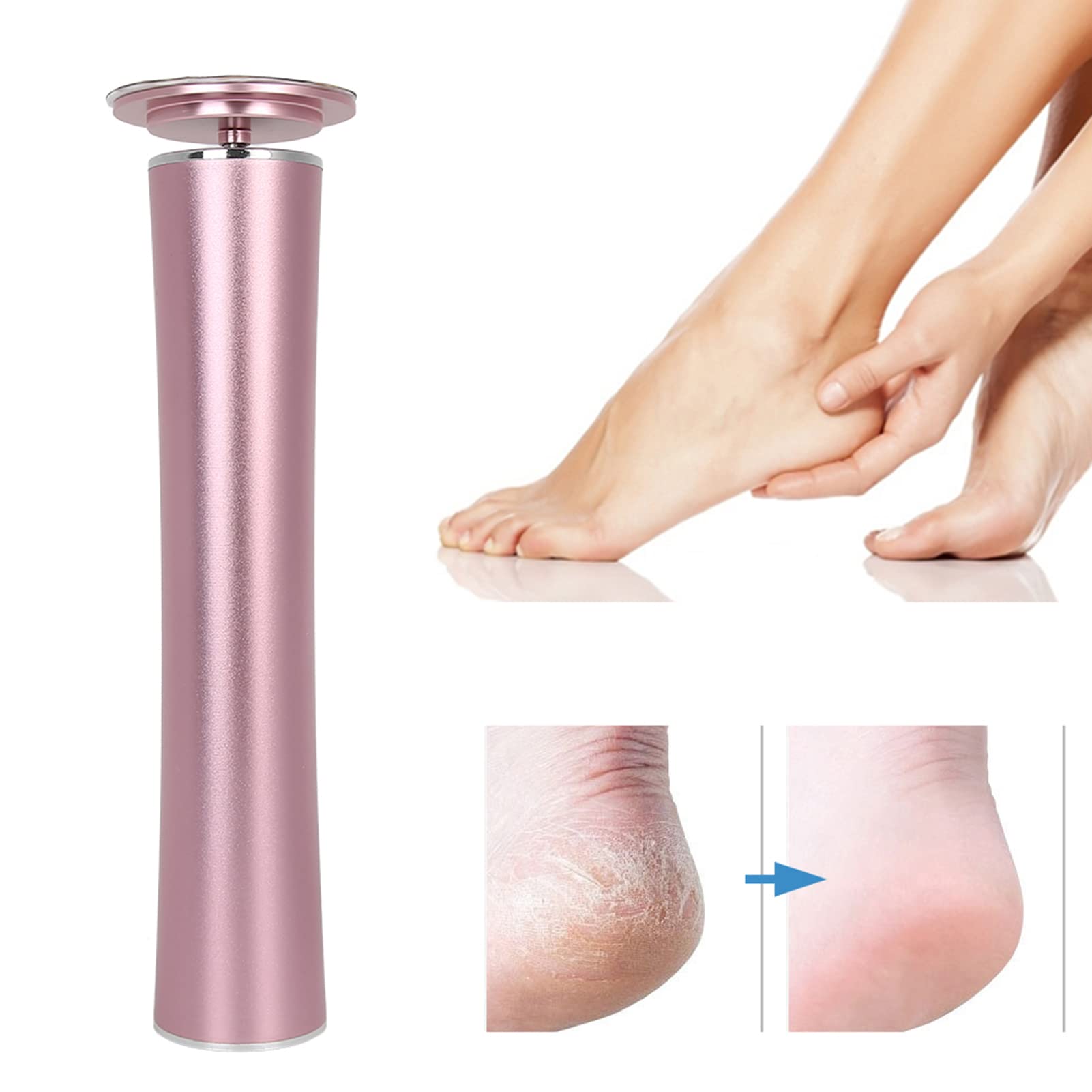 Electric Callus Remover for Feet - Rechargeable Automatic Foot File with Replaceable Blades | Professional Pedicure Tool for Dead Skin Removal | Perfect for Home Spa, Salon & DIY Foot Care