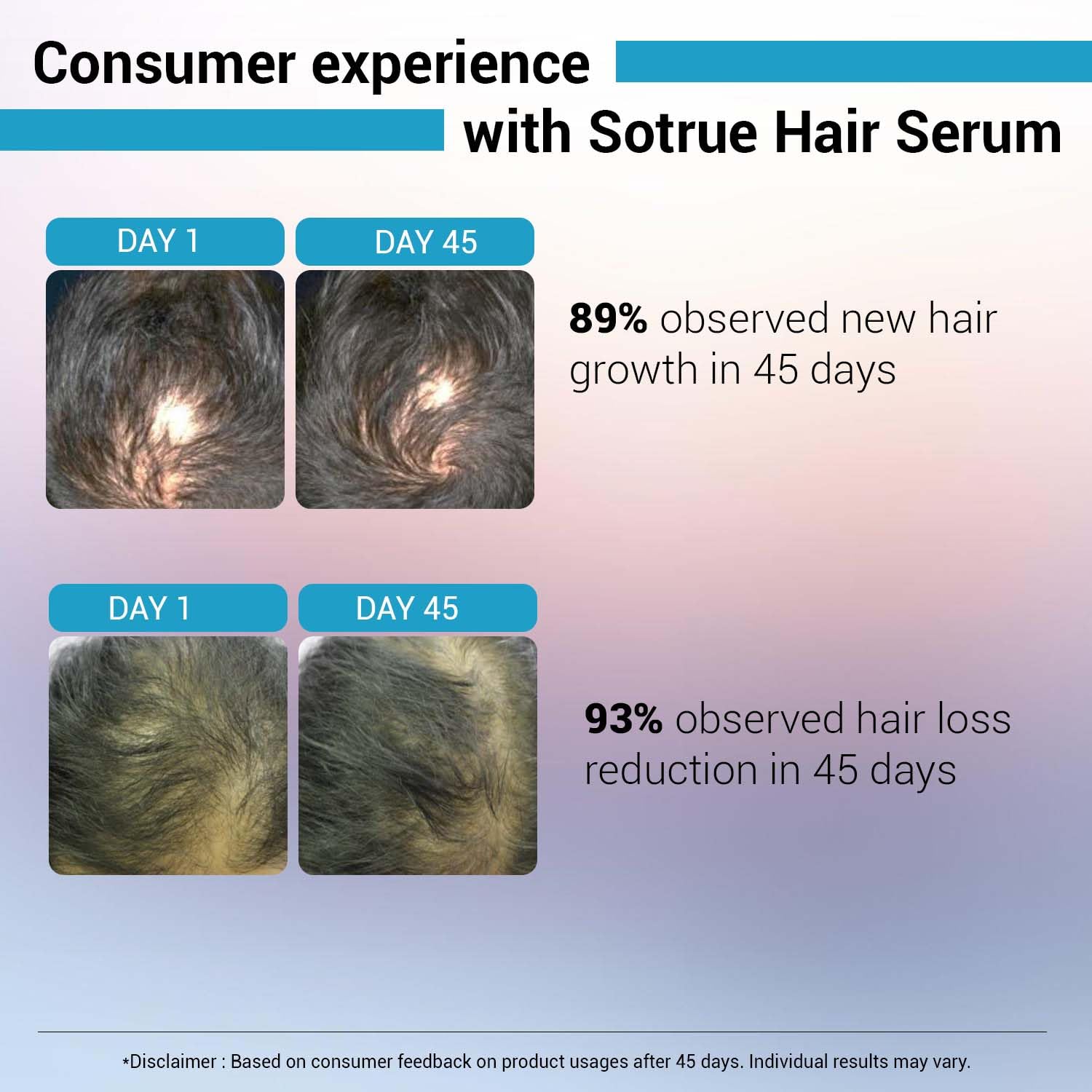 Sotrue Hair Growth Serum with Redensyl 3%, Procapil 3%, Anagain 4% & Baicapil 2% - Stimulates Hair Growth & Reduces Hair Fall for Women & Men - All Hair Types - 30ml - Perfect for Thinning Hair & Scalp Care