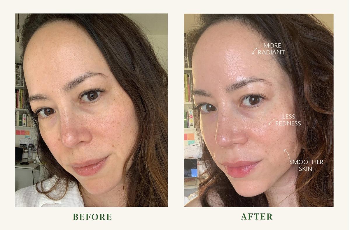 Bio Barrier Serum - Anti-Aging Face Serum with Hyaluronic Acid & Vitamin E for Hydration & Wrinkle Reduction | Perfect for Daily Skincare Routine & Nighttime Use