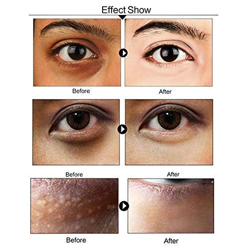 Zollyss 2-Pack Cooling Gel Eye Mask for Dark Circles & Puffiness Relief | Hydrating Dry Eyes & Reducing Redness | Reusable Cold Compress for Headaches & Pain | Sleep Mask for Men & Women | Perfect for Travel, Office & Home Use - Blue