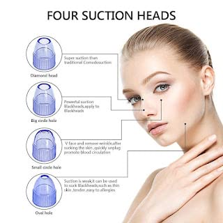 NL TRADERS Professional Acne Pore Cleaner Vacuum - Blackhead & Whitehead Remover Kit for Clear Skin | Derma Suction Tool for Pimple & Acne Treatment | Skin Care Device for Face Cleansing & Blemish Removal (White) | Perfect for Home Spa & Daily Skincare Routine
