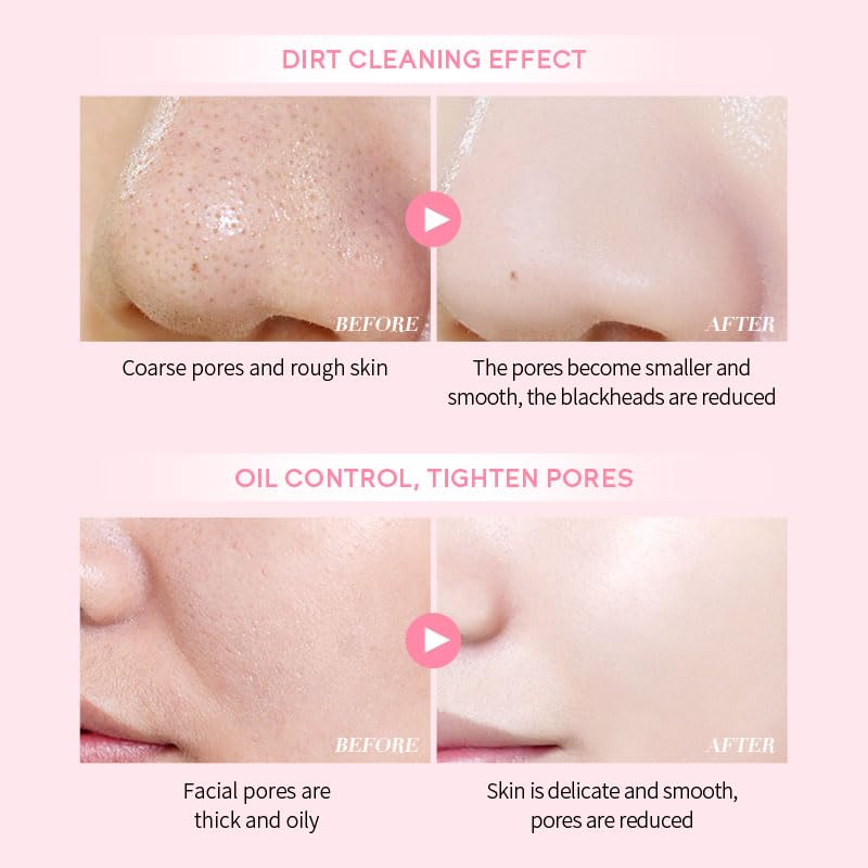 AKARY Sakura Clay Facial Mud Mask - Deep Cleanse & Pore Minimizer for Oily & Acne-Prone Skin | Natural Skin Care with Oil Control & Hydration | Reduces Fine Lines | Perfect for Spa Night & Self-Care Routine