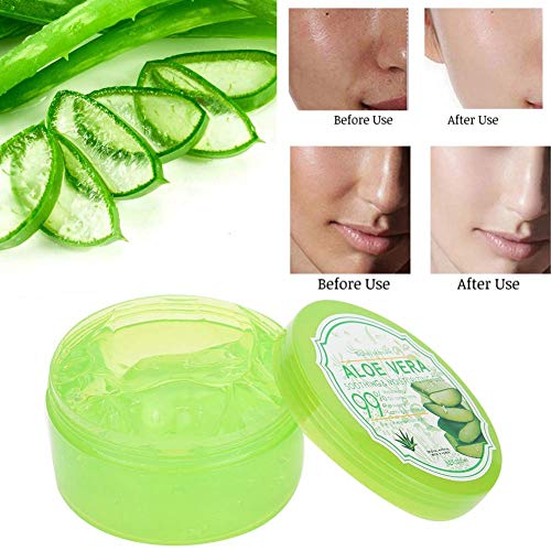 Organic 300g Aloe Vera Gel for Face & Body - Moisturizing Cream to Soothe Sunburn, Repair Damaged Skin, Reduce Acne Scars & Redness - Hydrates Dry Rough Skin, Anti-Inflammatory Care - Perfect for After Sun Care, Daily Skincare & Sensitive Skin Relief