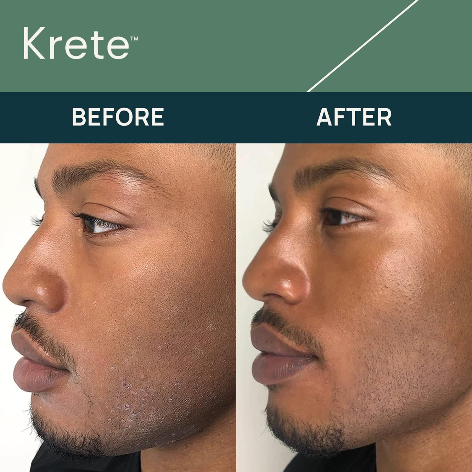 KRETE Men's Skincare System: Cooling Under-Eye Stick, Probiotic Facial Cleanser & Hydrating Serum - Vegan & Cruelty-Free Skincare Routine for Men - 30-Second Skincare Set with Facial Silicone Scrubber - Perfect for Morning & Night Routine, Travel & Gym Essentials