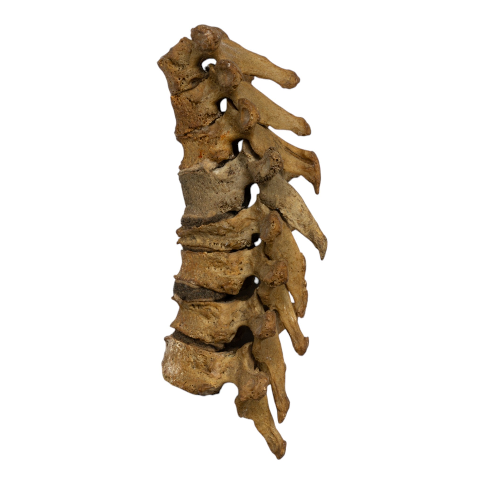 Authentic Human Thoracic Vertebrae Set of 8 - Perfect for Medical Education, Anatomy Study & Skeletal Display