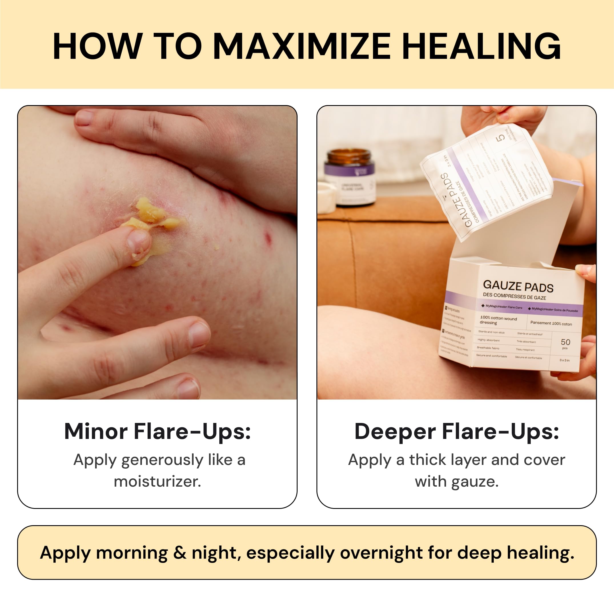 Universal Flare Care - Essential Oil Free Skin Relief for Eczema, Dermatitis, Psoriasis, Rashes & Baby Skin Issues | Propolis & Egg Yolk Formula | Soothes Hidradenitis, Chafing, Sores & Wounds | 1oz | Perfect for Daily Skincare & Sensitive Skin Care Routine