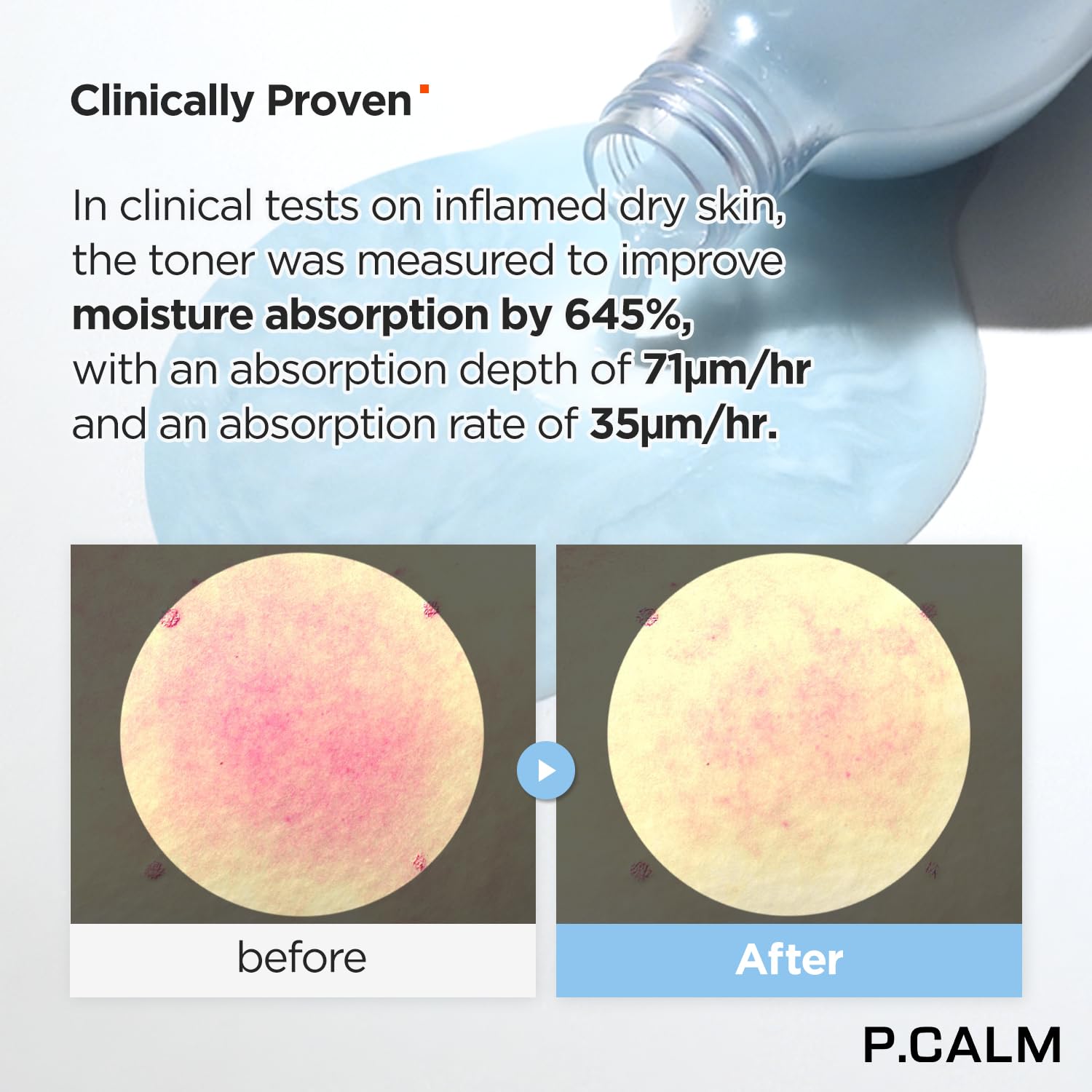 P.CALM Skin Barrier Boost Essentials – Korean Non-Comedogenic Skincare for Sensitive Skin | Vegan & Cruelty-Free | Daily Hydration & Redness Relief for Dry, Irritated Skin
