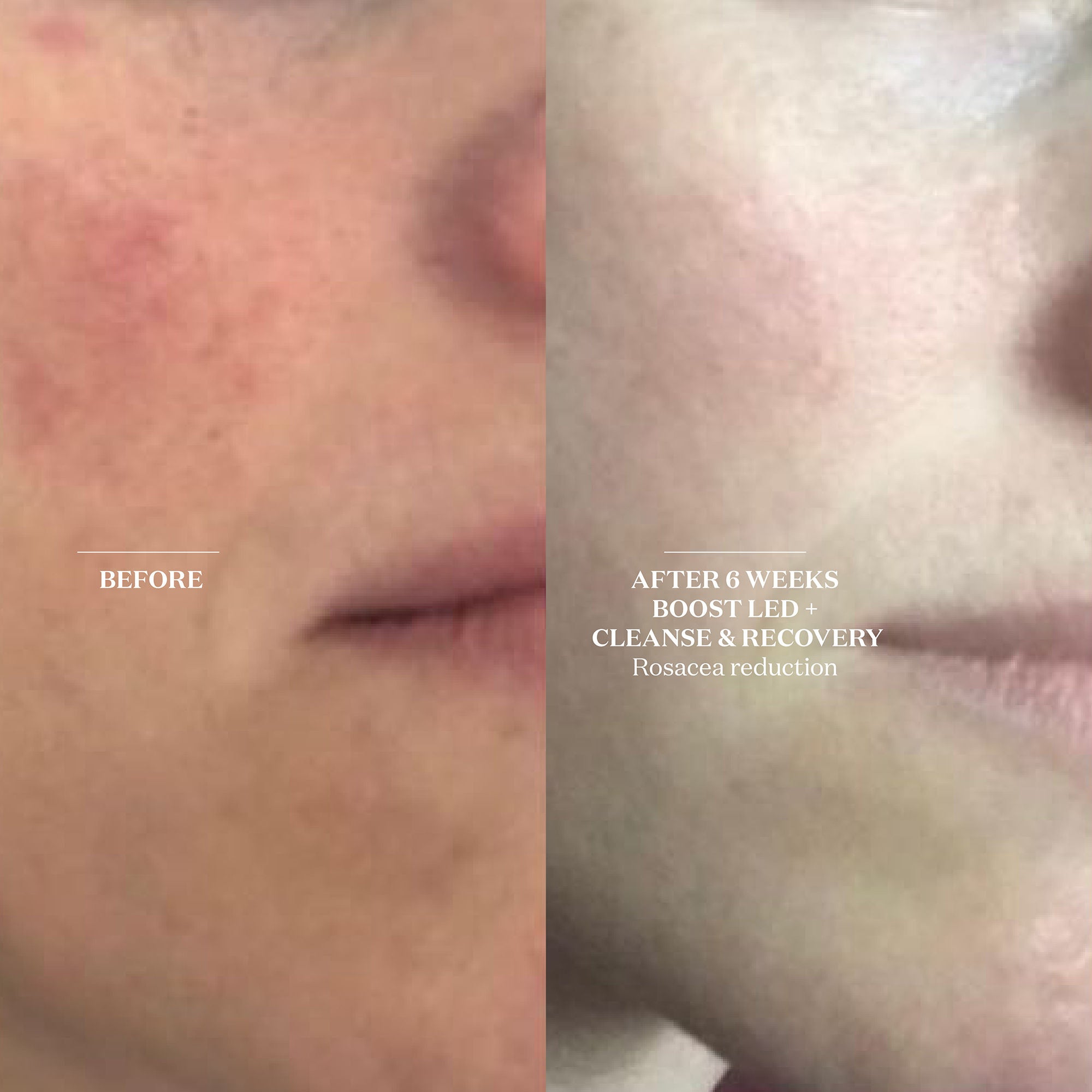 Cleanse & Recovery Spray - Detoxifying Facial Mist for Skin Refresh & Hydration | Perfect for Post-Workout, Travel & Daily Skincare Routine