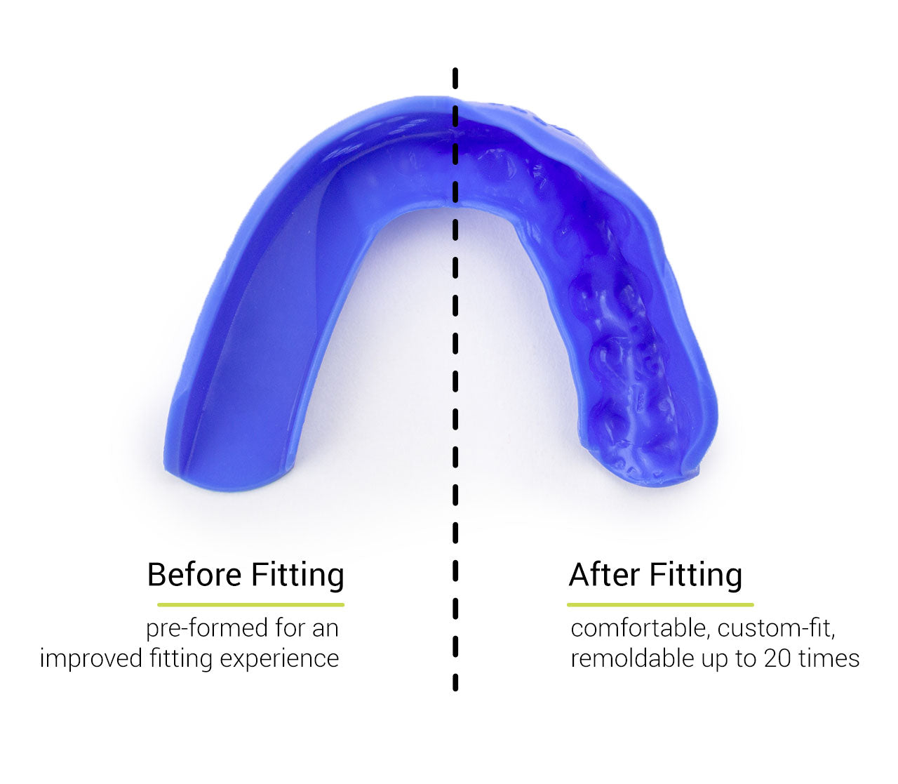 SISU 3D Custom Fit Mouthguard for Sports & Teeth Grinding - Comfortable Dental Night Guard for Boxing, MMA, Football & Sleep Bruxism Protection