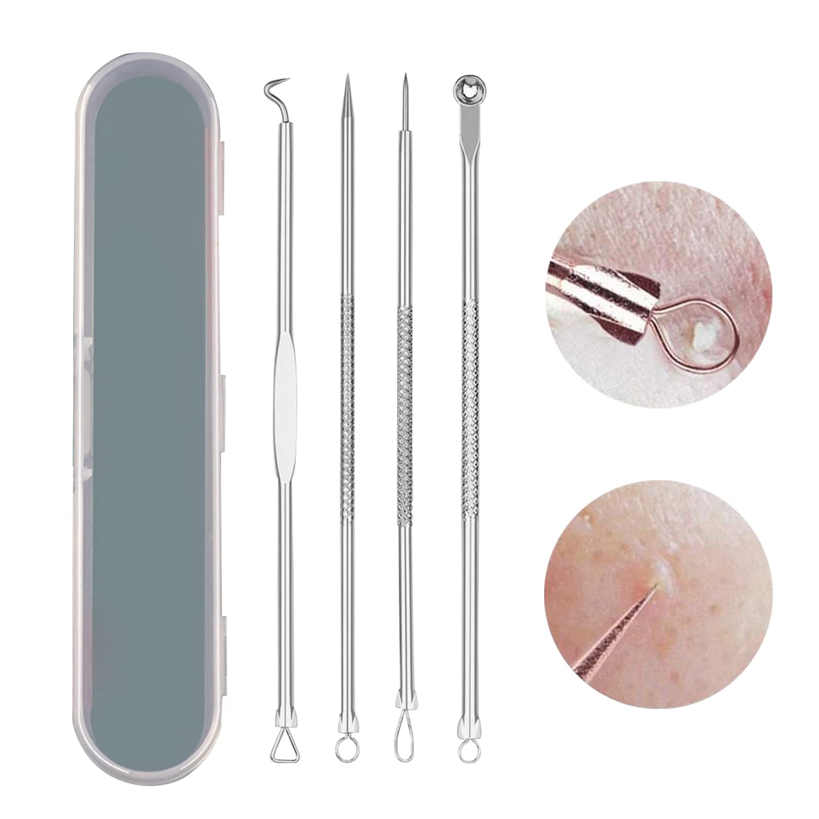 Professional Blackhead Remover Kit - 4pc Stainless Steel Comedone Extractor Tools for Acne, Blackheads & Whiteheads - Perfect for Home Facial Care & Skin Treatment