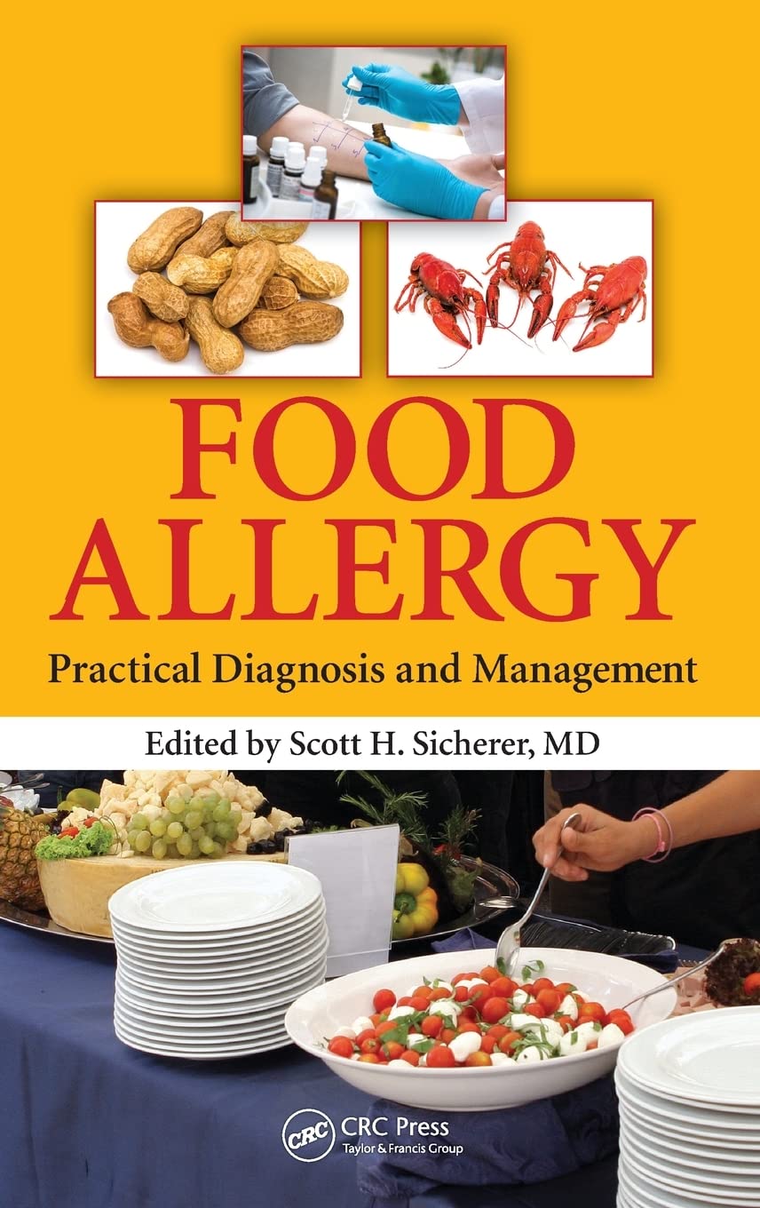 Food Allergy: Practical Diagnosis and Management Guide - Symptoms, Testing & Treatment for Allergic Reactions at Home & Clinics