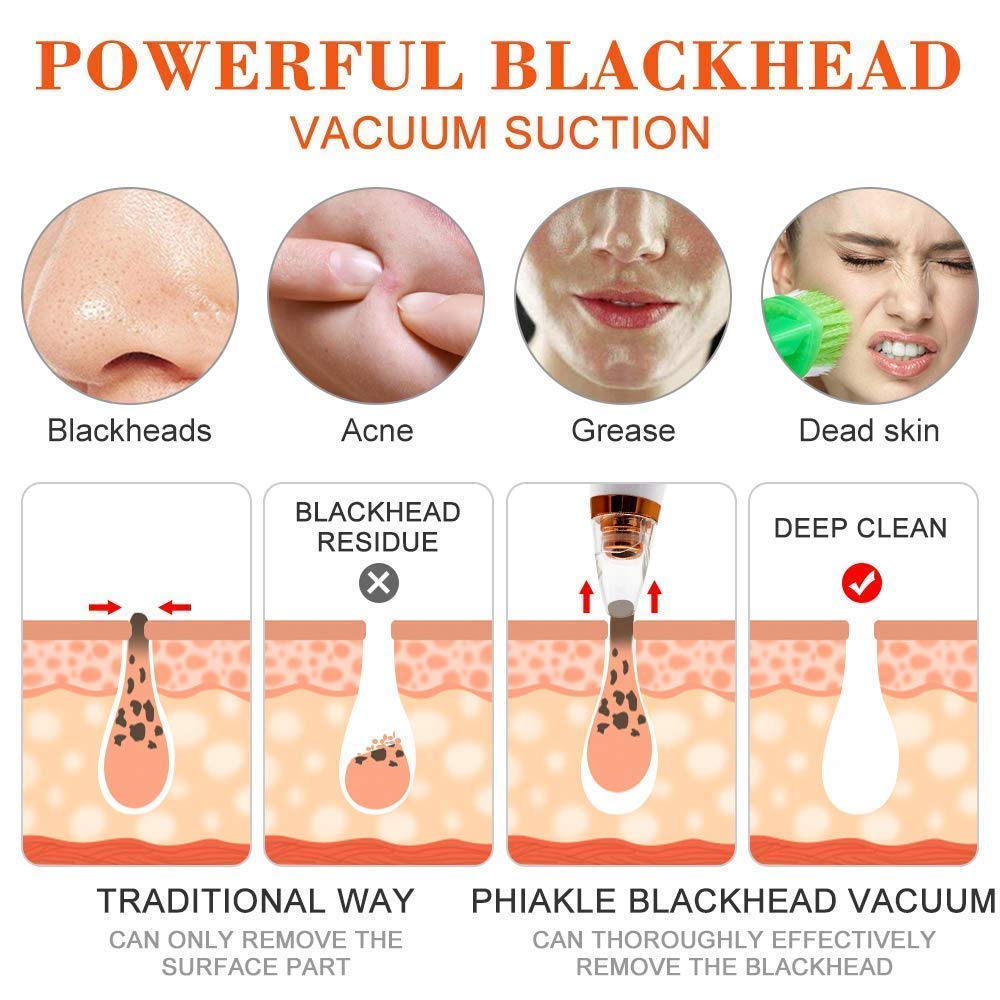 SHRADDHA SABURI Electric Blackhead Remover Vacuum - USB Rechargeable Pore Cleaner for Men & Women with 6 Suction Heads, LED Screen & 3 Cleaning Modes - Perfect for Deep Facial Cleansing & Acne Treatment at Home