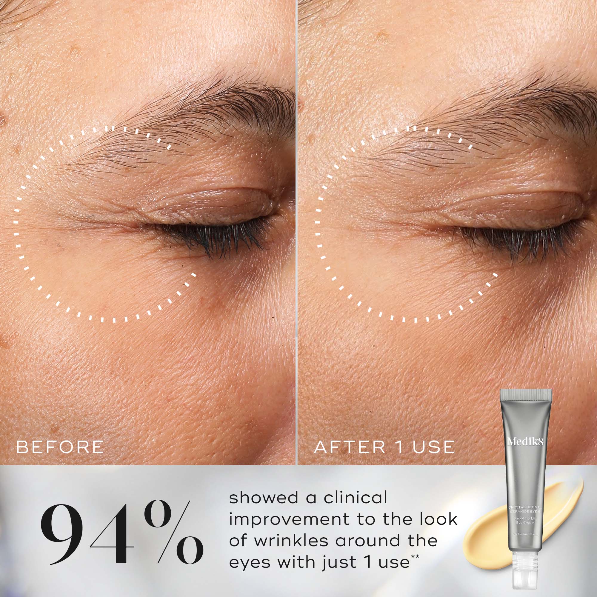 Crystal Retinal® Ceramide Eye Cream - Anti-Aging Eye Treatment for Dark Circles, Wrinkles & Puffiness - Hydrating & Firming Under Eye Cream for Women & Men - Perfect for Night & Day Skincare Routine