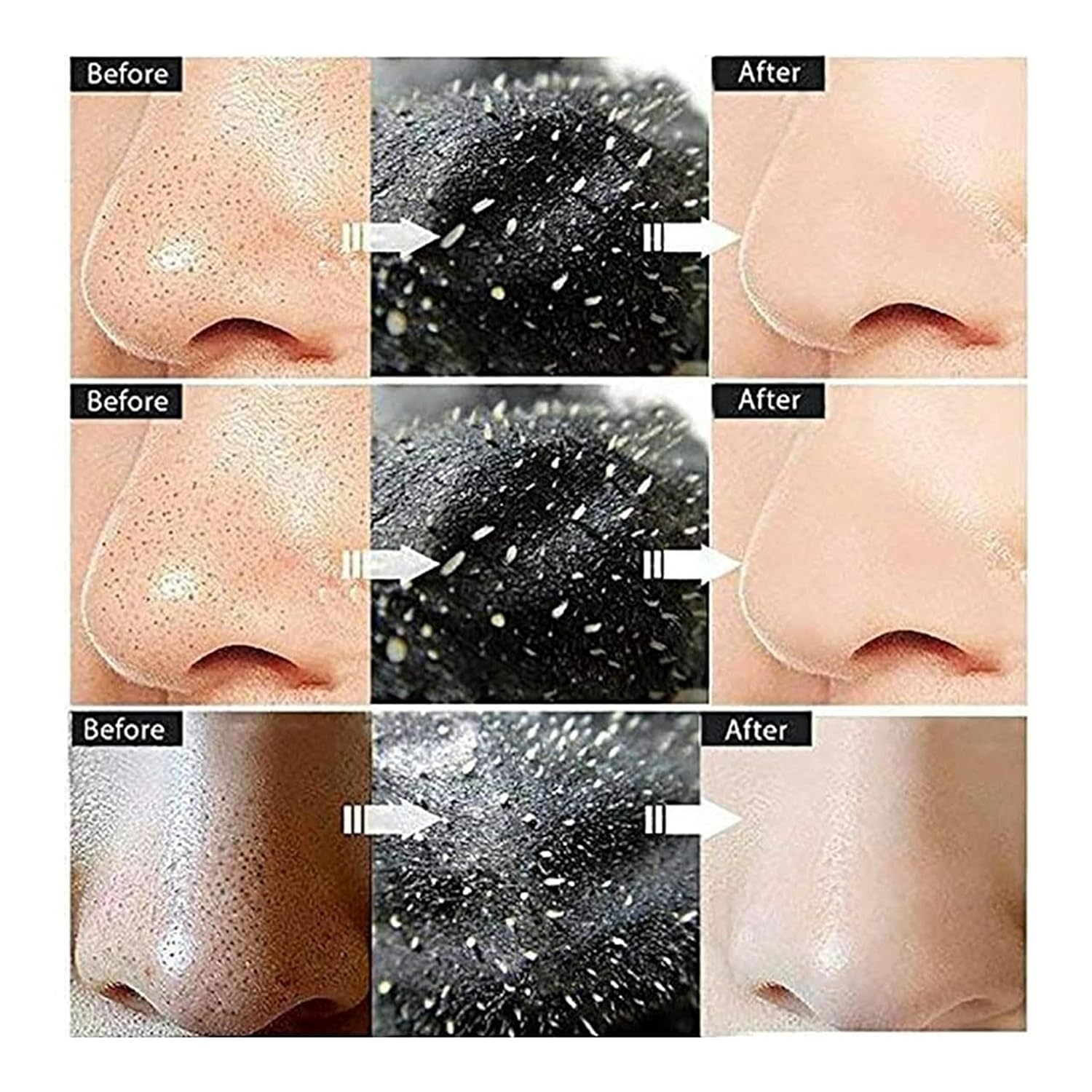 Green Tea & Charcoal Clay Face Mask Set - Purifying Stick Mask & Peel Off Mask for Oil Control, Anti-Acne & Deep Cleansing | Detoxifying Facial Treatment for Oily & Problem Skin | Perfect for Daily Skincare Routine & Spa Night