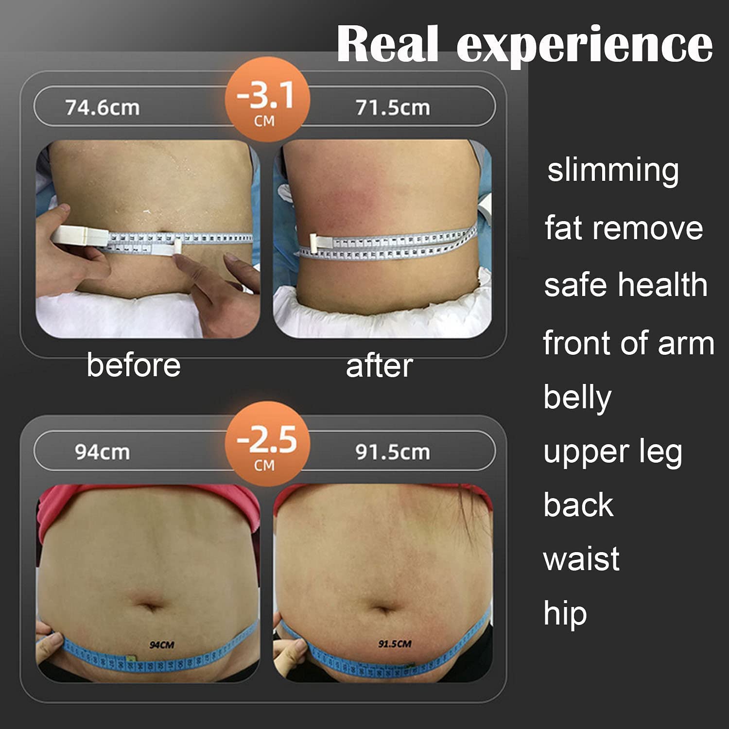 6-in-1 Professional Body Lipo Cavitation Machine for Fat Removal & Skin Tightening | Non-Invasive Body Sculpting & Skin Care Spa Device | Perfect for Home Use & Professional Clinics