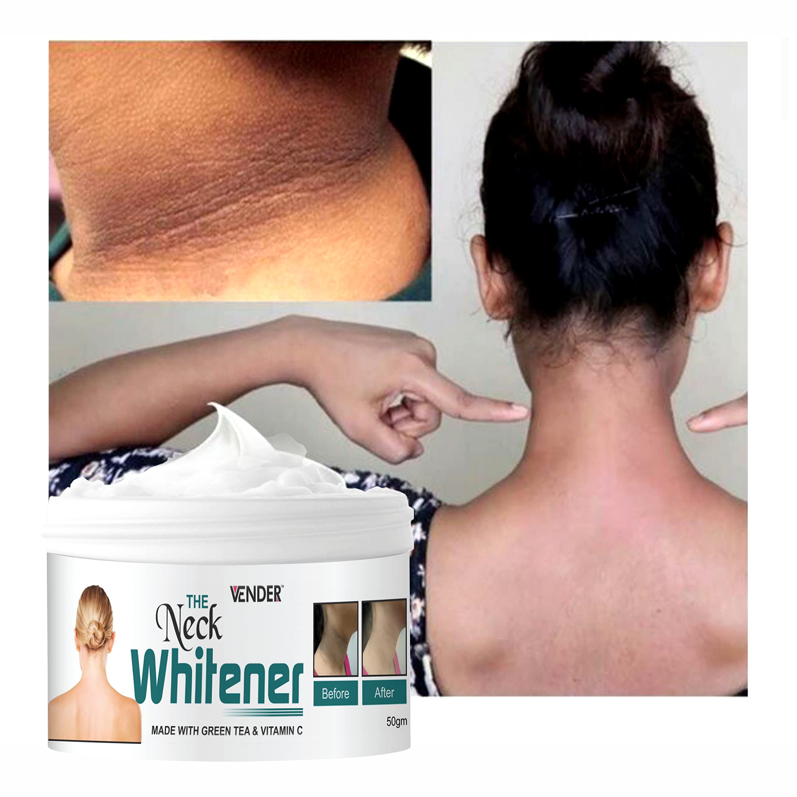 Best Green Tea & Vitamin C Brightening Cream for Dark Neck, Knees & Elbows - 50g | Hydrating & Lightening Skin Care for Hyperpigmentation | Perfect for Daily Use & Night Routine