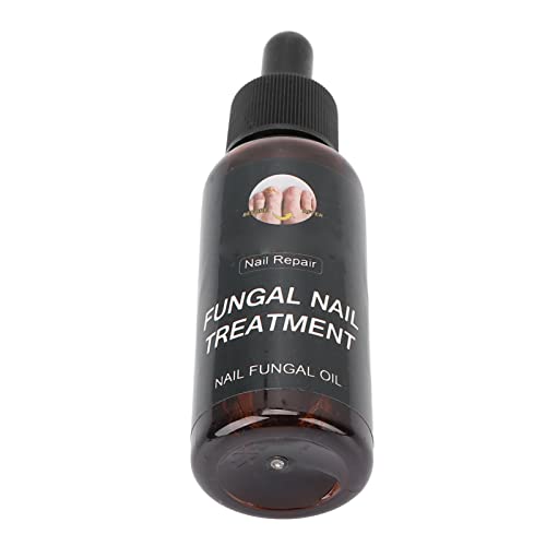 Nail Repair Liquid - Safe & Mild 50ml Toenail Treatment for Nourishment & Protection | Home & Salon Nail Care Solution for Damaged & Brittle Nails