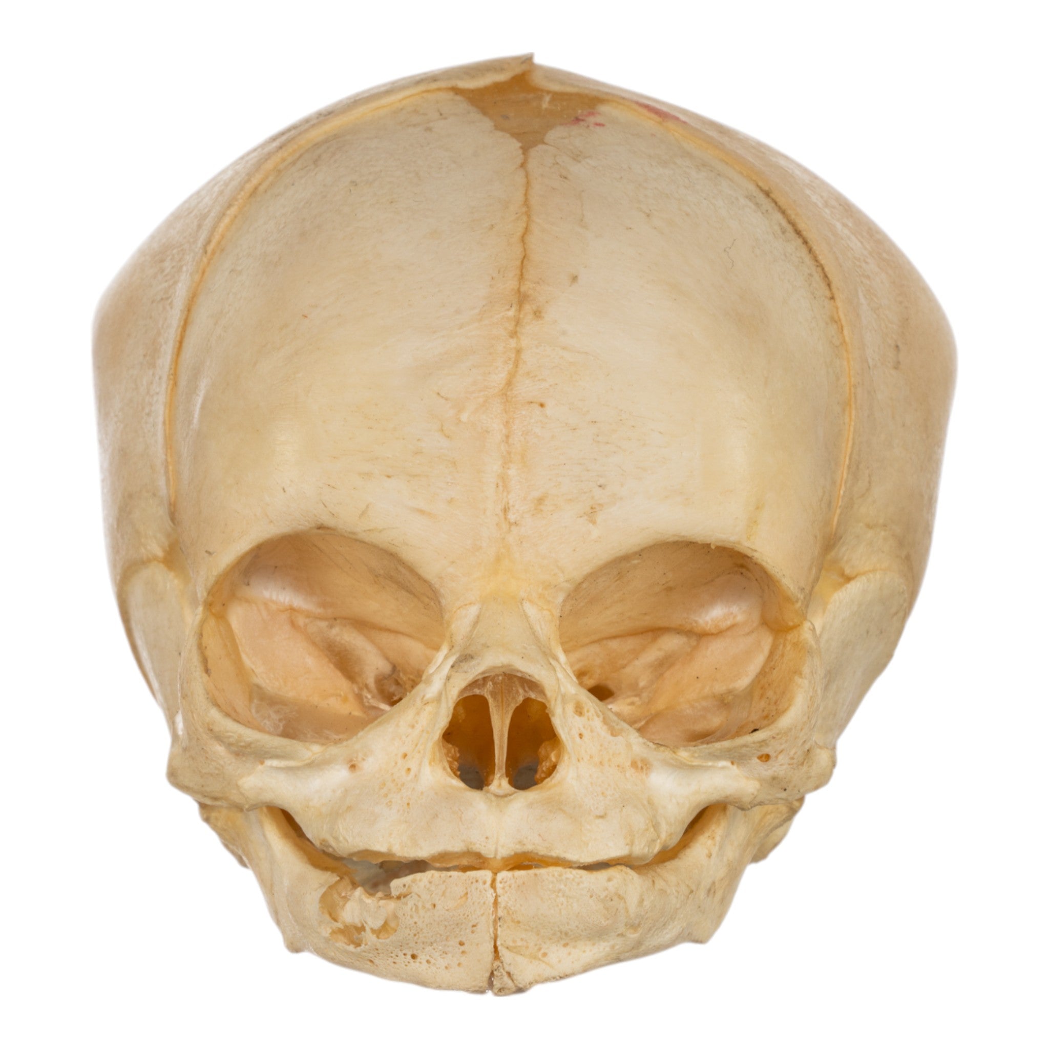 Authentic Human Fetal Skull Specimen - Medical Education, Anatomy Study & Forensic Research - Ideal for Medical Schools, Laboratories & Scientific Collections