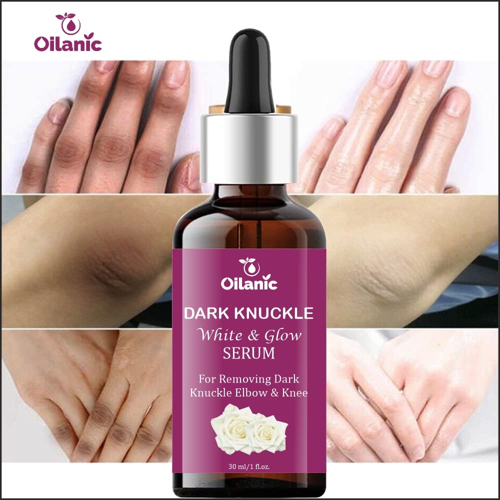 Oilanic Dark Knuckle Serum for Dark Spot Removal & Skin Brightening (30ml) | Hydrating & Nourishing Formula for Smooth Skin | Lightweight Non-Greasy Daily Skincare | Perfect for Dry Elbows, Knees & Knuckles