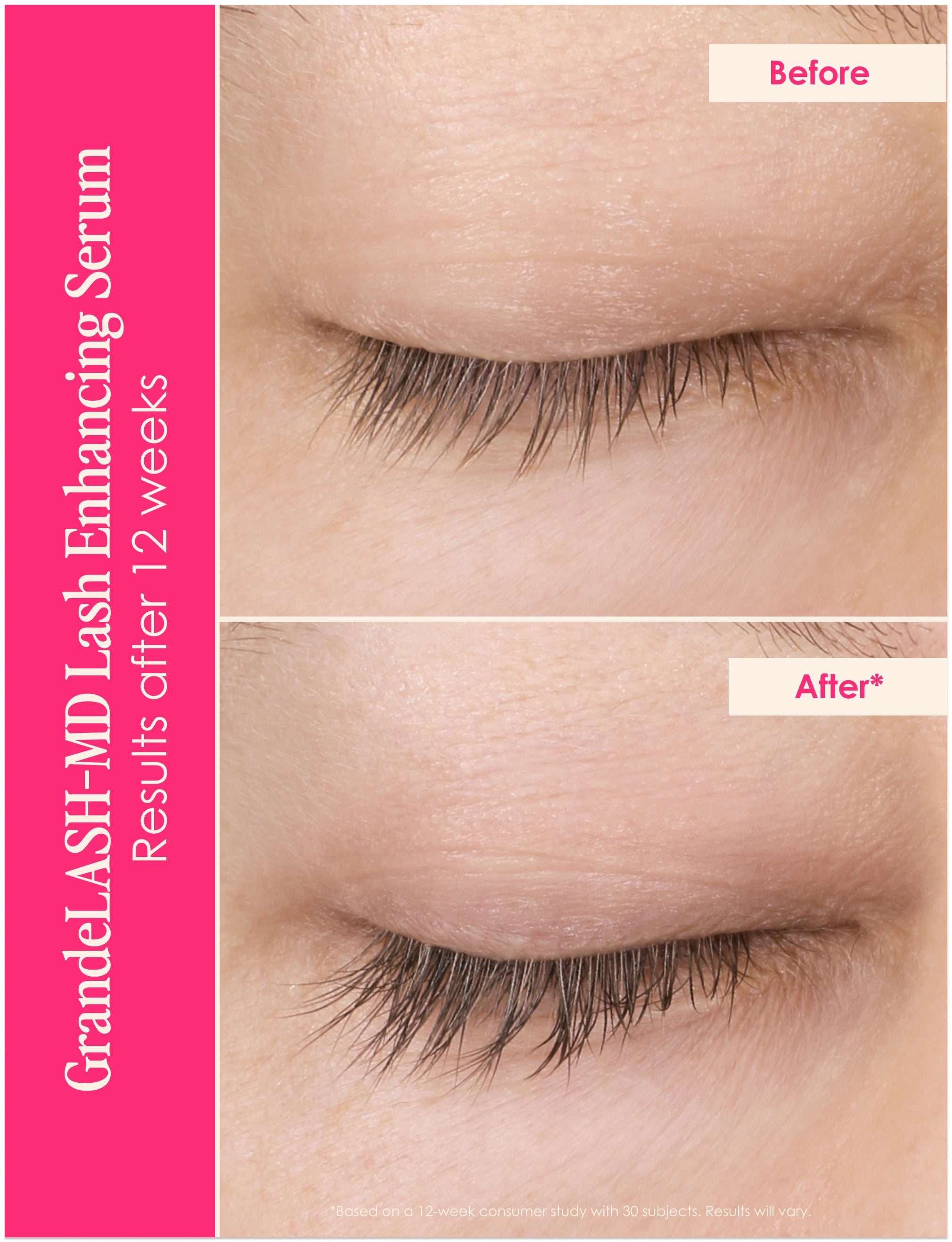 Lash & Brow Legends - Professional Eyelash & Eyebrow Growth Serum for Thicker, Fuller Lashes & Brows | Perfect for Daily Use & Special Occasions