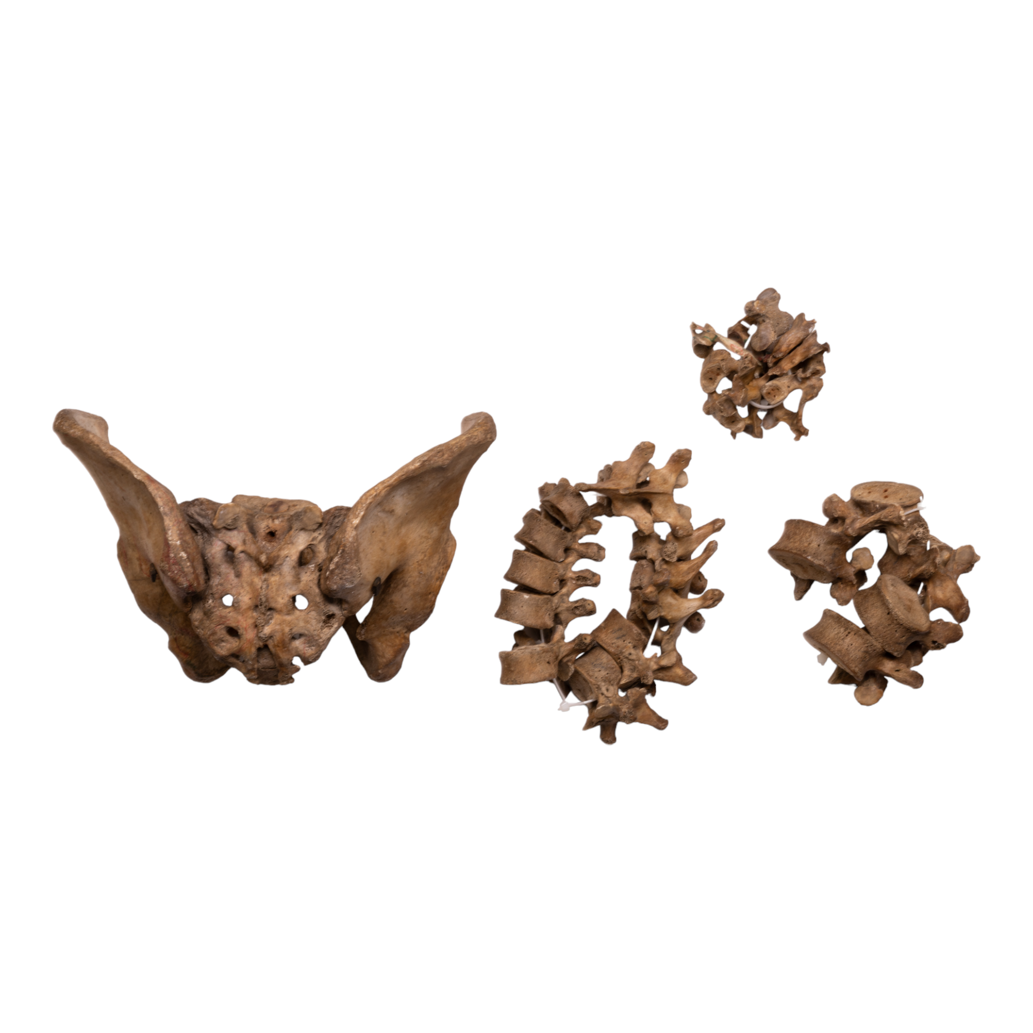 Authentic Human Spine, Sacrum & Pelvis Model - Medical Anatomy Study, Chiropractic Training, Classroom Demonstration