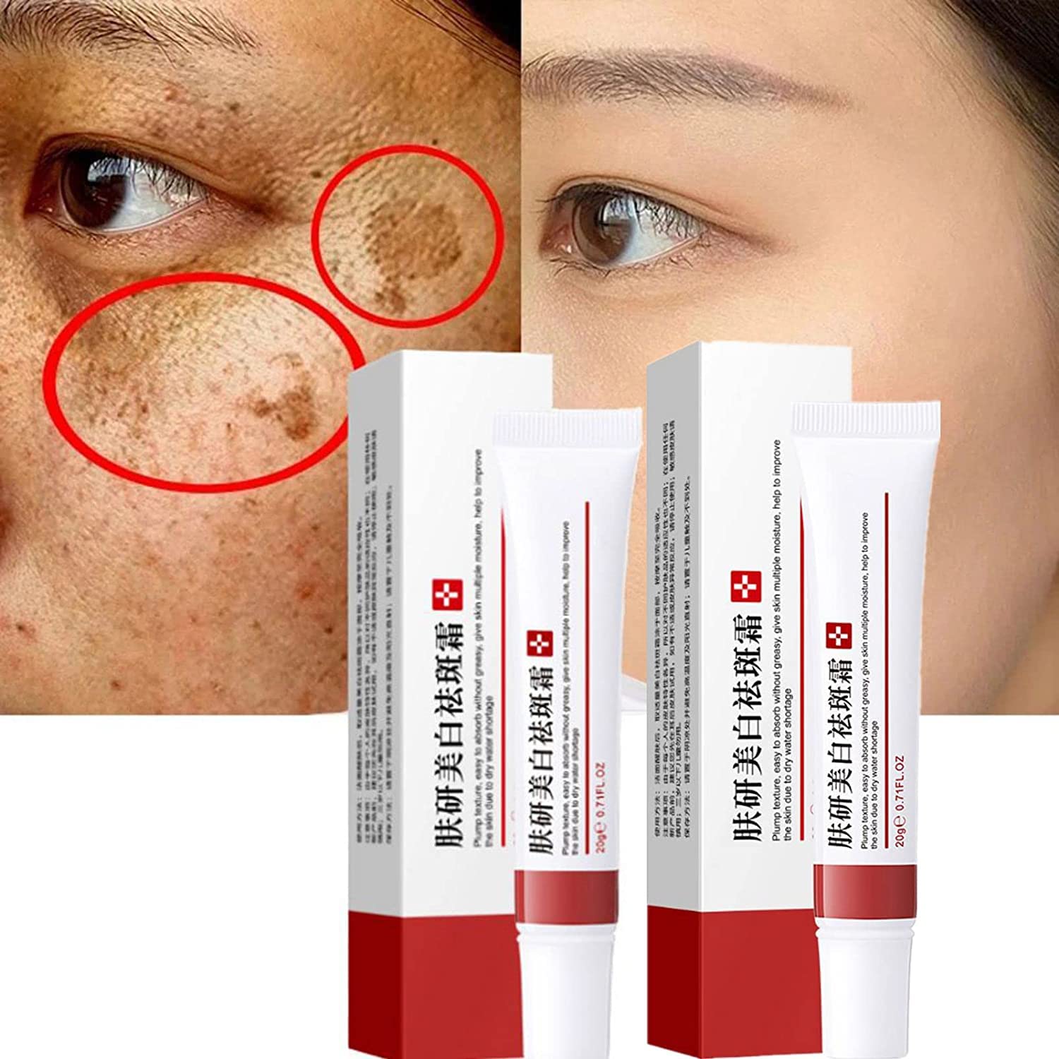 LUCKKY 2PCS Whitening Freckle Cream - Dark Spot Corrector, Scar & Pigmentation Treatment for Face with Moisturizing Formula | Brightens Skin, Reduces Blemishes & Freckles | Perfect for Daily Skincare Routine & Nighttime Treatment
