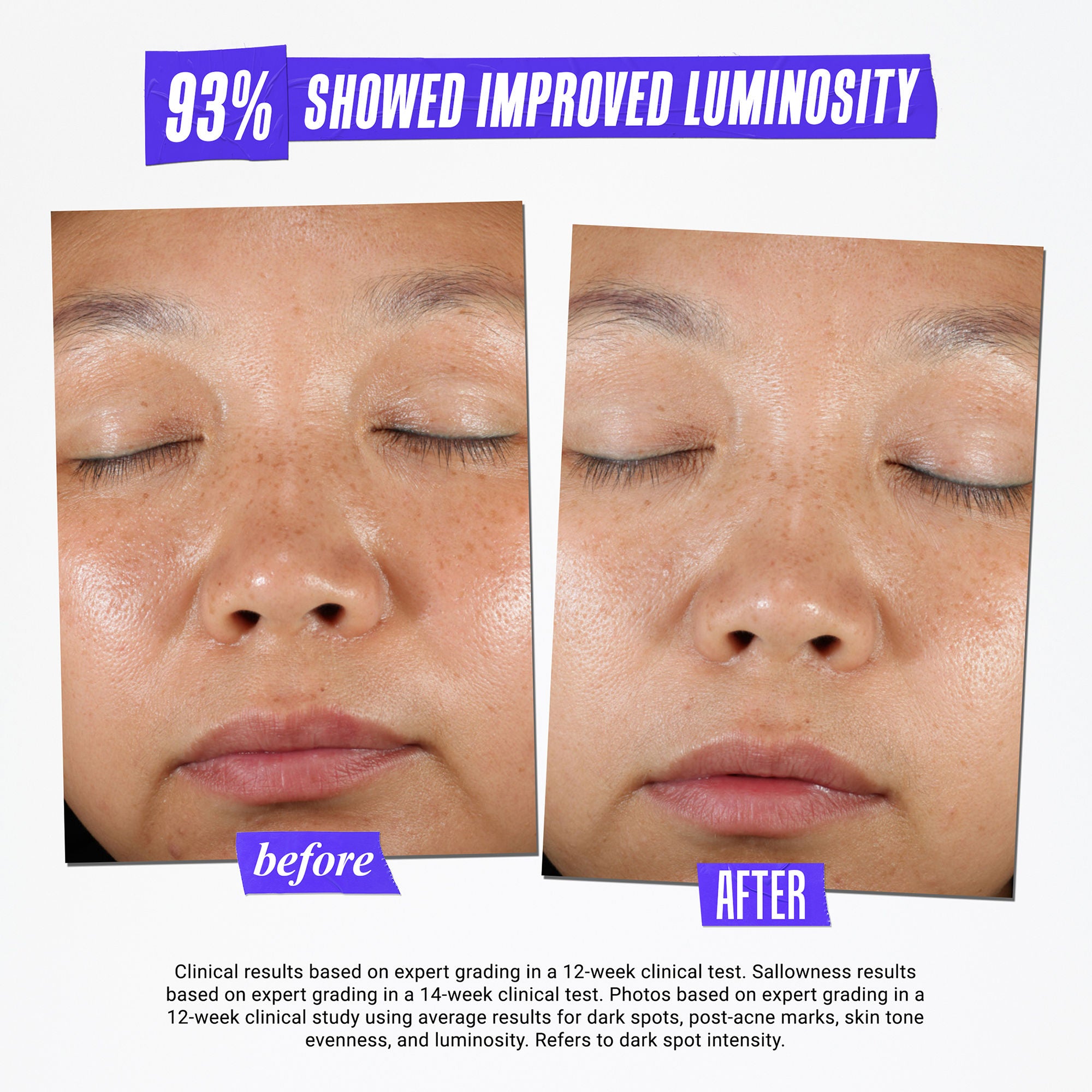 Kiehl's Clearly Corrective Dark Spot Solution - Brightening Serum for Hyperpigmentation & Uneven Skin Tone | Perfect for Daily Skincare Routine & Nighttime Use