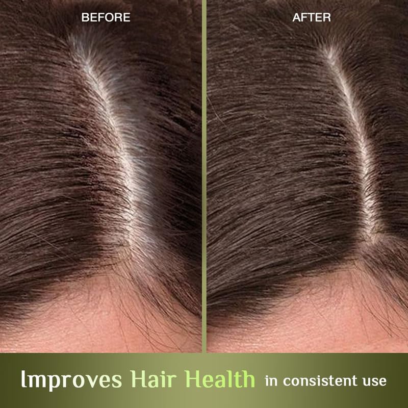 Richfeel Hair Nourisher Oil for Hair Fall Control & Growth Treatment | Trichologist-Developed Formula with High Concentration | 10ml | Reduces Breakage & Promotes Healthy Hair for Men & Women | Perfect for Daily Hair Care Routine & Scalp Massage