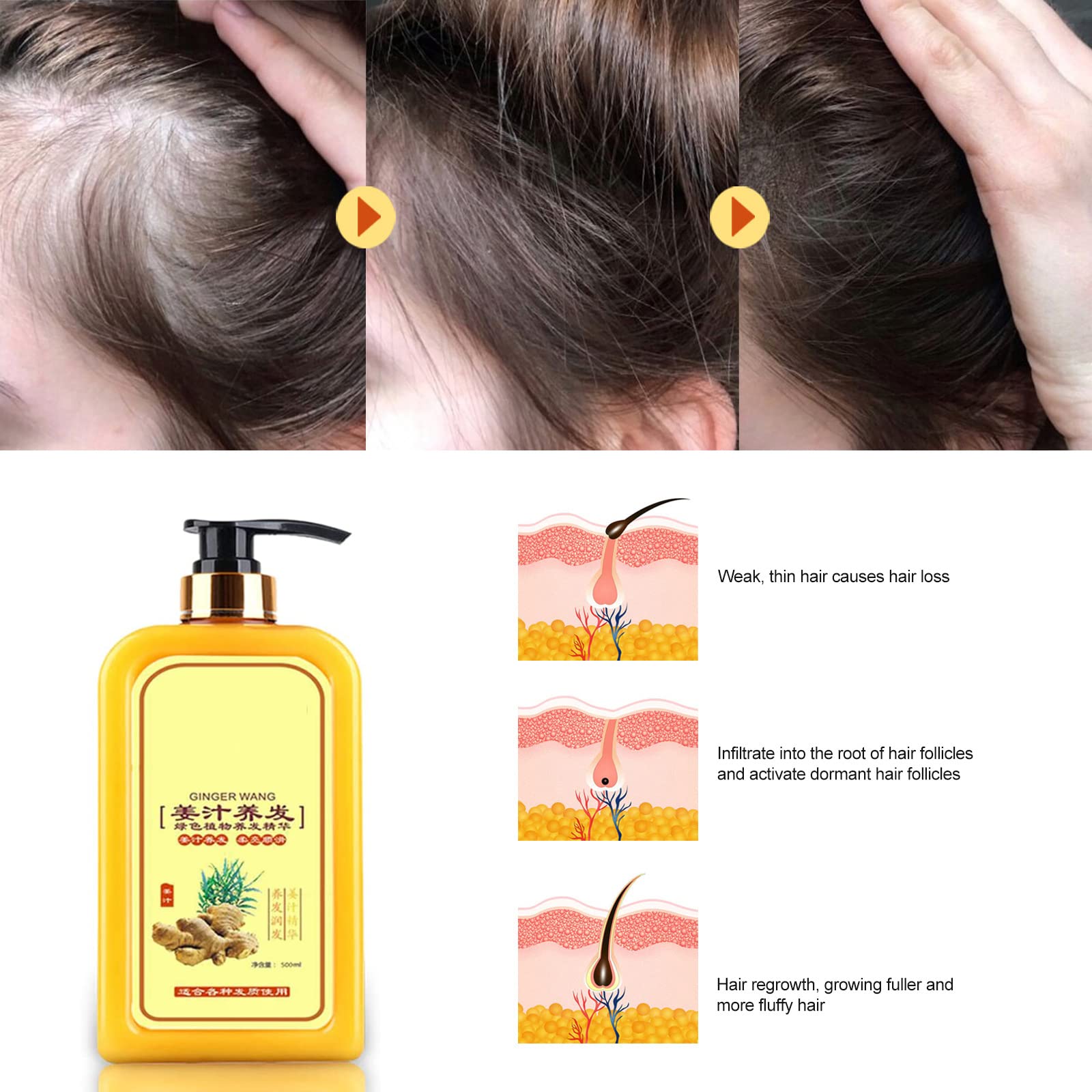 Ginaday Instant Ginger Hair Regrowth Shampoo 500ml - Natural Ginger Shampoo for Hair Growth & Thinning Hair Treatment | Anti-Hair Loss & Scalp Care | Promotes Thicker, Healthier Hair | Perfect for Daily Use & Hair Recovery