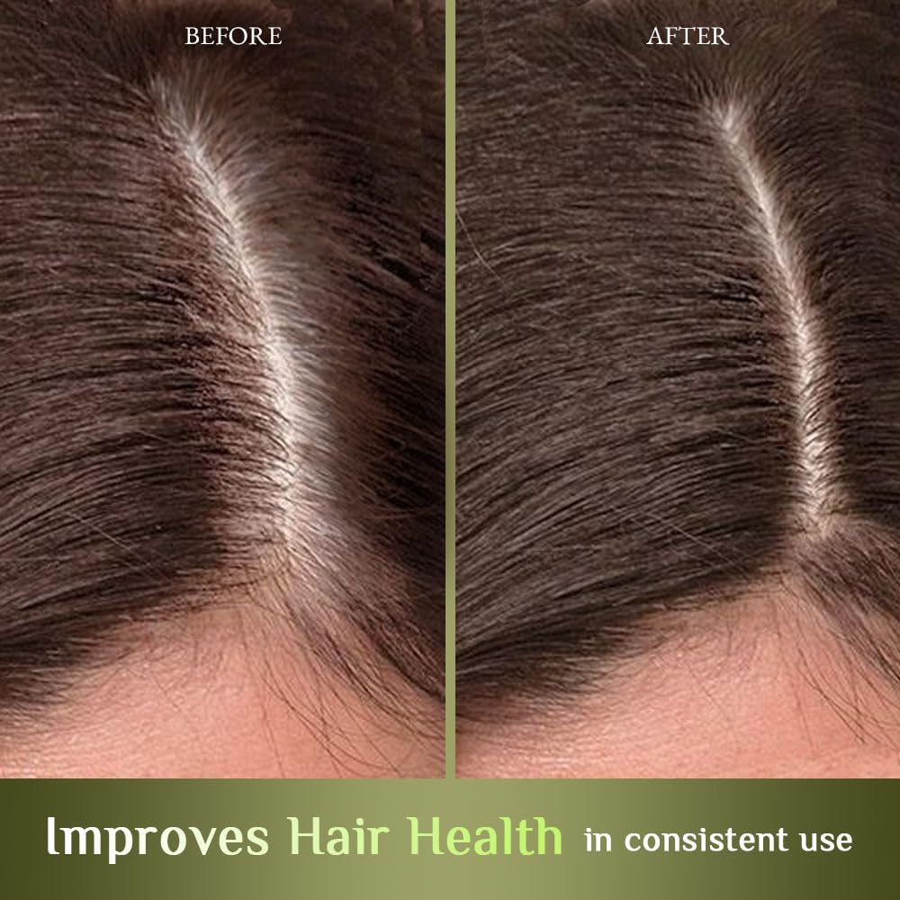 Richfeel Hair Root Nourisher & Tonic for Hair Fall Control & Growth - Trichologist Developed Formula | High Concentration Oil-Free & Silicone-Free Treatment (80ml) | Perfect for Thinning Hair, Scalp Care & Daily Hair Regimen