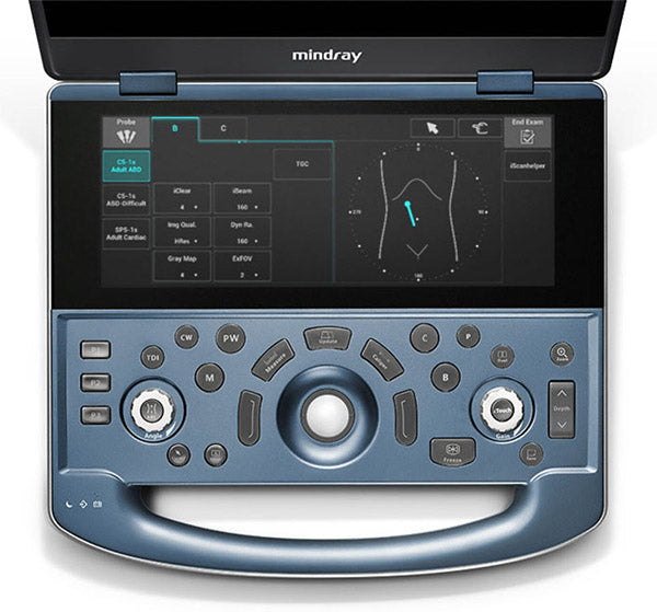 Mindray MX7 Ultrasound Machine with OBGYN Package - Includes 2 High-Frequency Probes for Obstetrics & Gynecology - Perfect for Clinics, Hospitals & Medical Practices