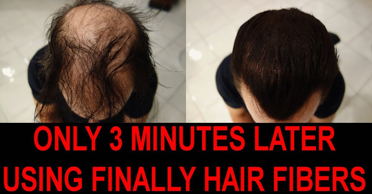 Finally Hair Fiber Refill 250g (8.82oz) - Light Medium Blonde Hair Loss Concealer for Thinning Hair & Bald Spots - Natural-Looking Cover for Men & Women - Perfect for Daily Use & Special Occasions