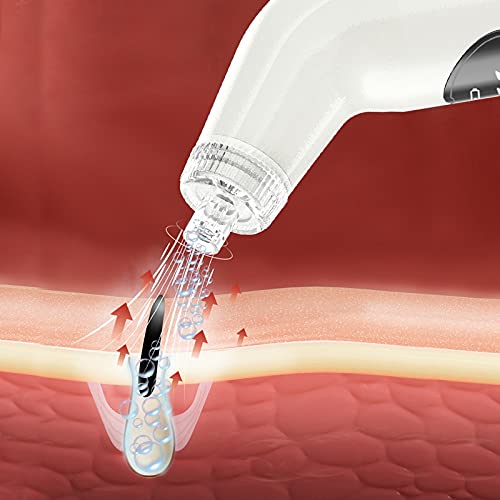 Professional COSYOO Electric Pore Cleaner Kit - 3 Speed Blackhead & Acne Remover Vacuum for Deep Facial Cleansing | Perfect for Women & Teens | At-Home Spa Treatment & Pre-Makeup Skin Prep