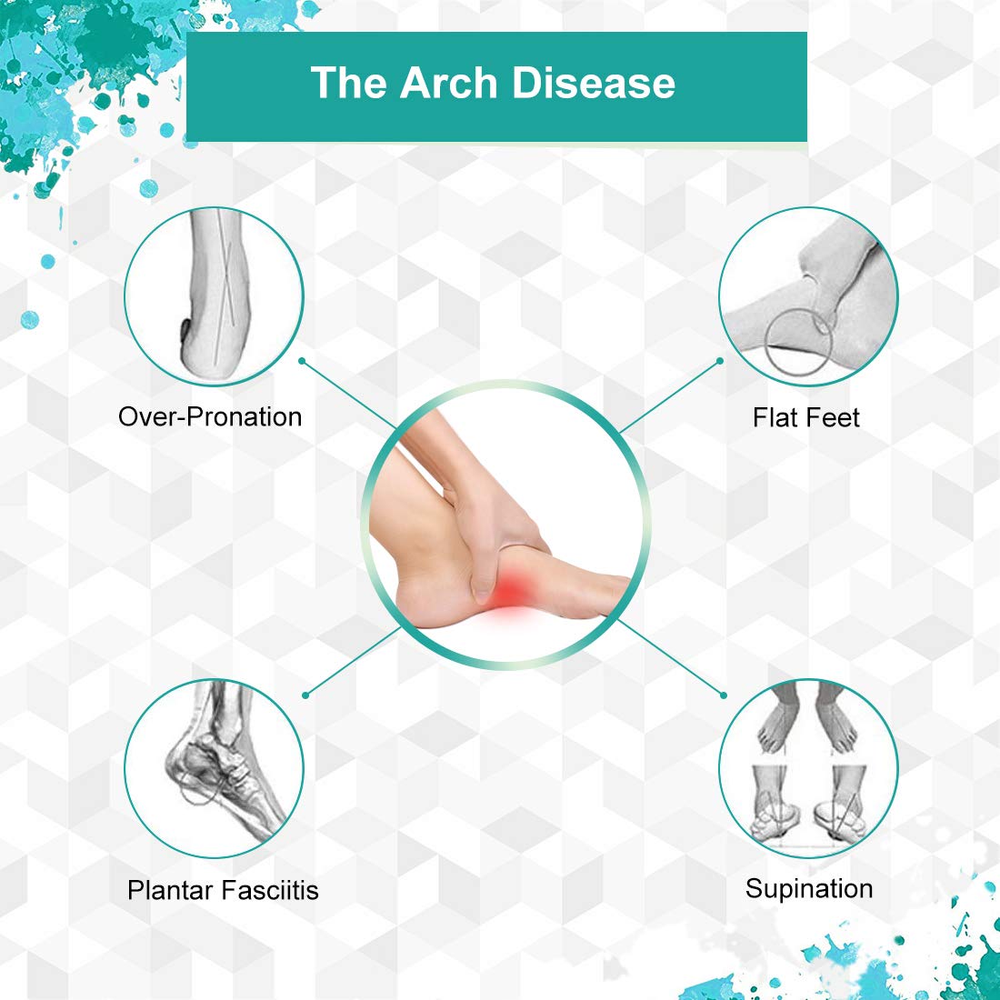 Plantar Fasciitis Arch Support Gel Pads - Soft Silicone Arch Sleeves with Cushioning for Flat Feet & Fallen Arches - Heel & Foot Pain Relief Insoles (2 Pairs) - Ideal for Running, Walking & Standing All Day