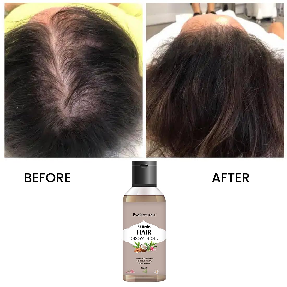 EvaNaturals 35 Herbs Hair Growth Oil - Natural Hair Loss Treatment for Men & Women | Nourishes & Stimulates Healthy Hair Growth | 100ml | Perfect for Thinning Hair, Scalp Massage & Daily Hair Care