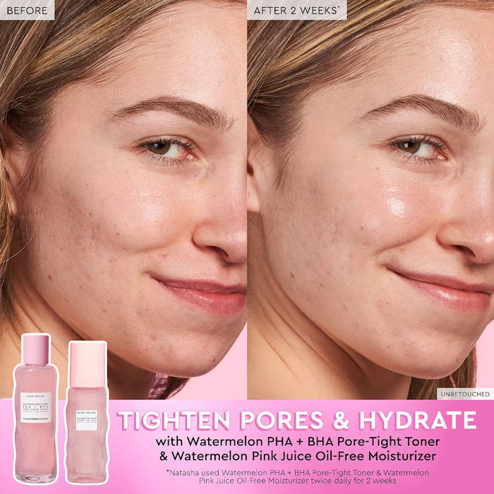 Watermelon Glow PHA + BHA Pore Minimizing Facial Toner | Glow Recipe | Hydrating & Brightening for Oily & Combination Skin | Daily Skincare Routine