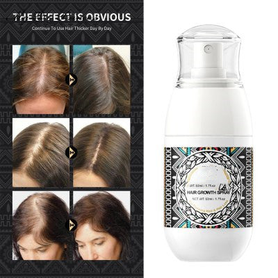 Rice Water Hair Growth Spray - Hydrating Scalp Treatment for Dry & Damaged Hair - Perfect for Daily Use & Hair Care Routine