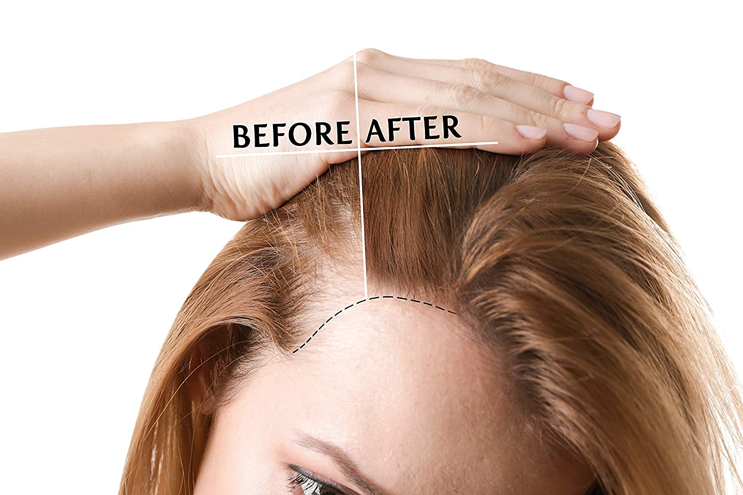 Rice Water Hair Growth Spray - 100% Natural Fermented Herbal Mist with Aloe Vera & D-Panthenol for Scalp Care - Strengthens Dry, Oily & Brittle Hair - Ideal for Locs, Dreads & Damaged Hair - Antioxidant-Rich Leave-In Conditioner for Daily Hair Growth Routine