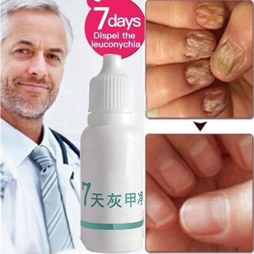 Comtervi 10ml Nail Repair Treatment for Toenail Fungus - Antifungal Nail Care Solution for Healthy Toenails - Perfect for Athletes, Swimmers & Pedicure Lovers