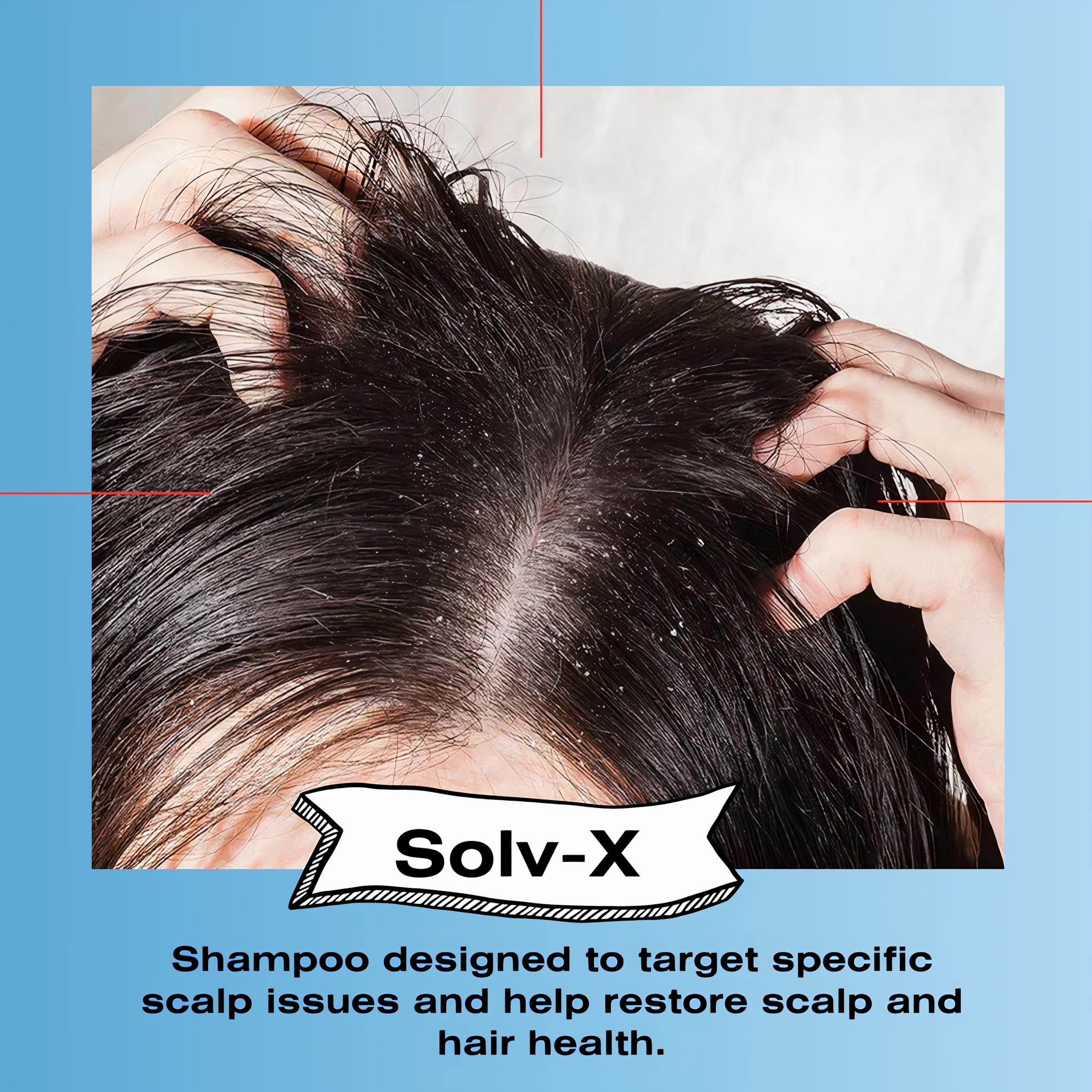 Mediceuticals Solv-X Shampoo for Oily Hair & Scalp - Scalp Acne Treatment Shampoo for Men, Women & Teens - 8.45 oz (250 ml) - Deep Cleansing & Oil Control for Healthy Scalp - Perfect for Daily Use & Scalp Care Routine