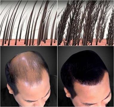 Hair Building Fiber for Thinning Hair - Topik Cabok Refill Pack (Black, 25g x 2) | Instant Hair Loss Concealer for Men & Women | Perfect for Daily Use, Special Occasions & Confidence Boosting