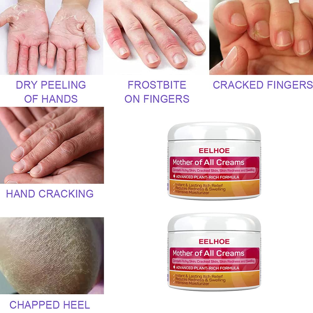 **2 Pack Ultra Hydrating Face & Foot Cream - Intense Moisturizer for Dry, Chapped Skin with Dead Skin Exfoliation - Anti-Drying Body Lotion for Daily Use at Home or Travel**