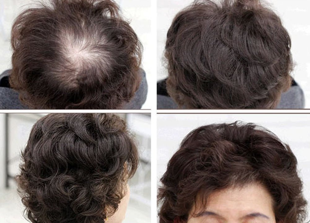Remeehi 6 Inch Curly Human Hair Topper - Seamless Fluffy Hair Replacement for Women, Natural Black (#2) - Perfect for Thinning Hair, Daily Wear & Special Occasions