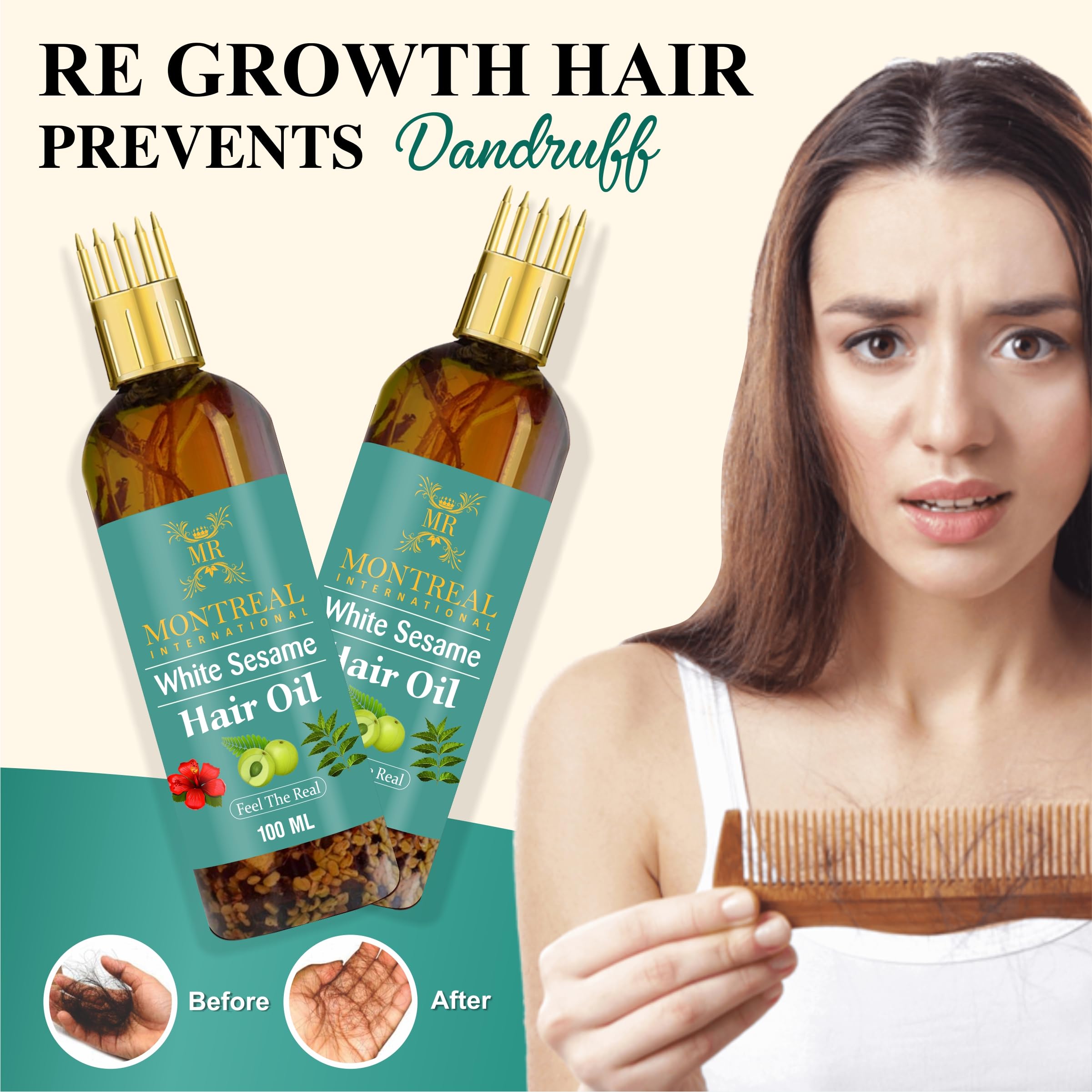 Montrel International Ayurvedic Jadibuti Hair Oil - 100ml Natural Herbal Treatment for Hair Fall Control & Growth | Perfect for Daily Scalp Massage & Damaged Hair Care