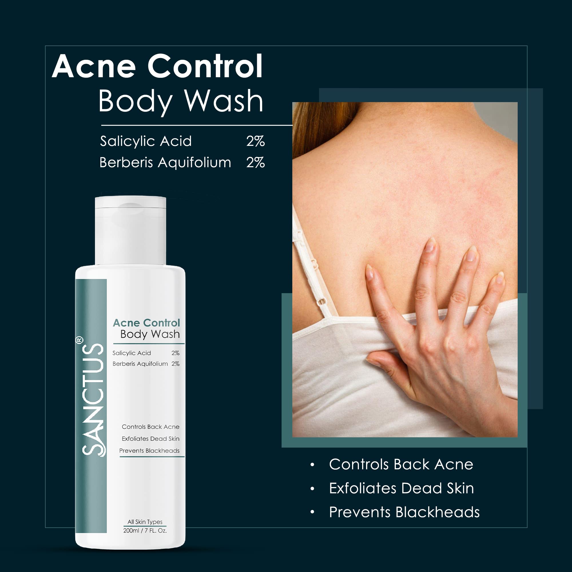 Acne Control Body Wash with 2% Salicylic Acid & 2% Berberis Aquifolium - Prevents Body Acne, Bumpy Skin & Deep Pore Cleansing - 200ml - Ideal for Shower & Post-Workout Skincare Routine