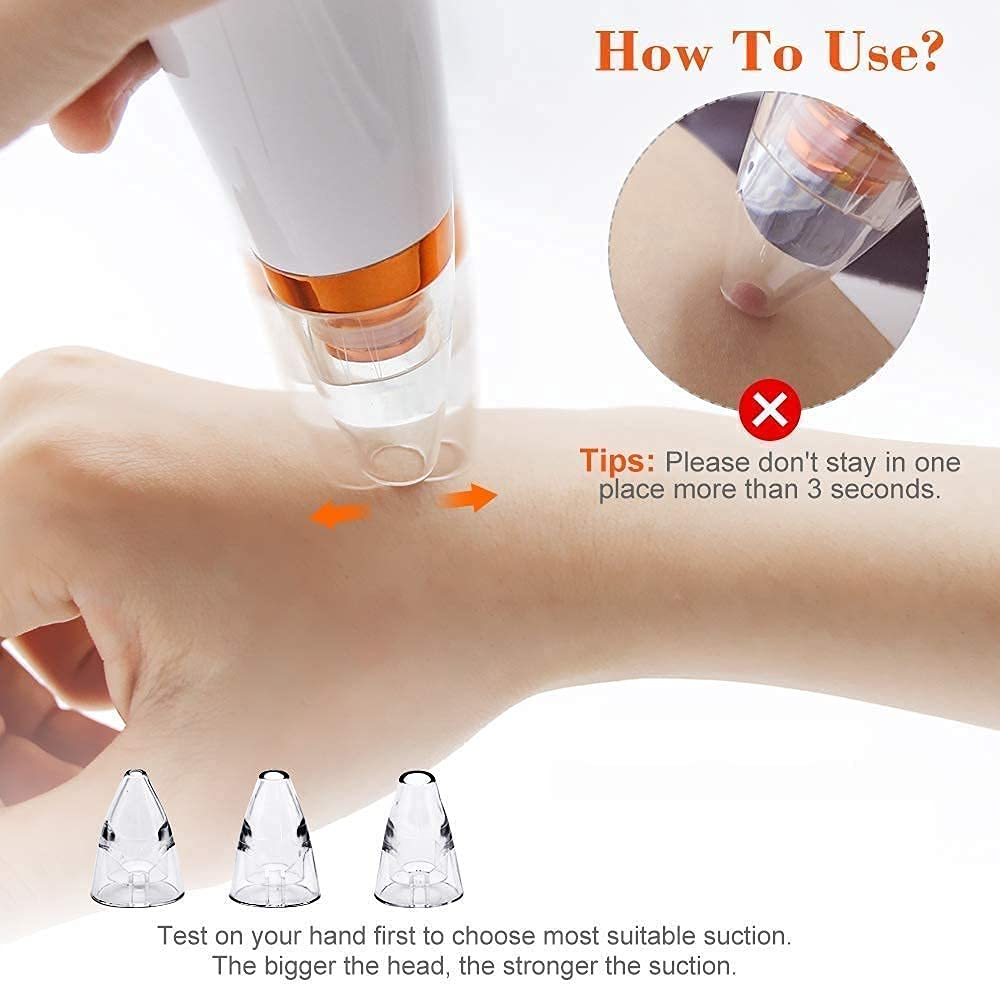 PIPALIYA Professional Acne Pore Cleaner & Blackhead Remover Vacuum Kit - Skin Care Tool for Pimple & Blemish Removal - Perfect for Daily Facial Cleansing & Spa Treatments