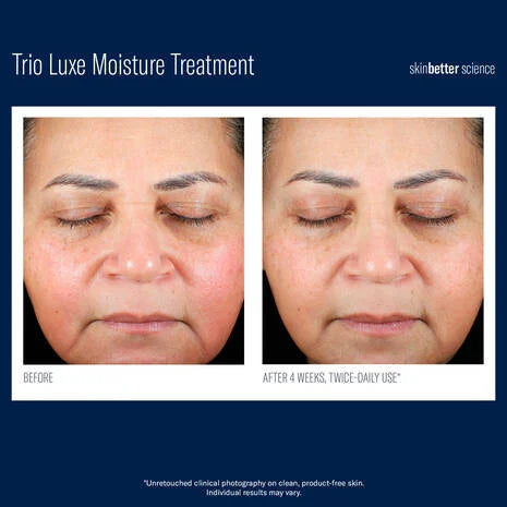 Trio Luxe Deep Moisture Hair Treatment - 50ml | Hydrating & Repairing Leave-In Conditioner for Dry, Damaged Hair - Perfect for Daily Use & Salon-Quality Results at Home