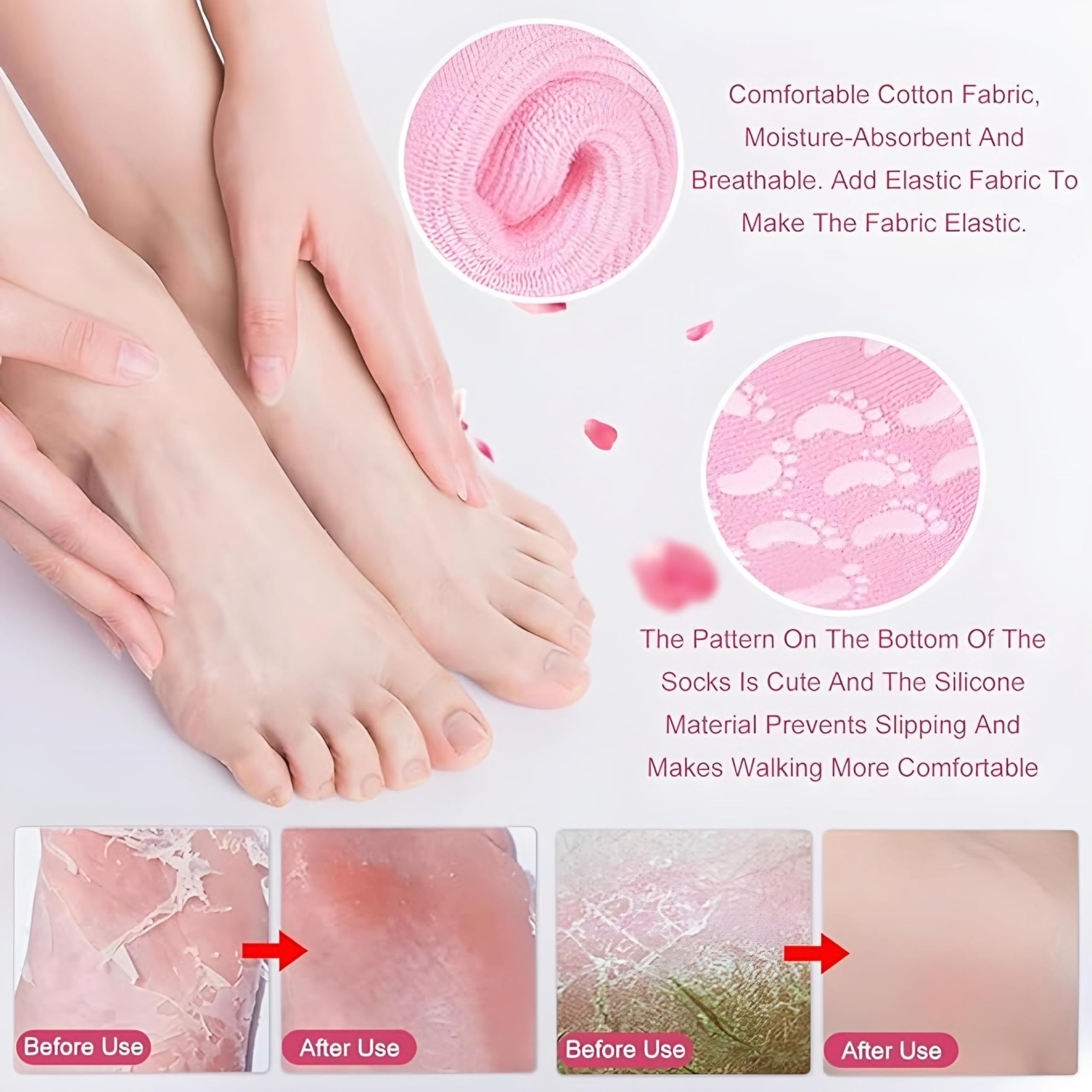 DS CARE Moisturizing Silicone Gel Socks for Dry Cracked Feet - Heel Repair & Foot Moisturizer Socks with Natural Oil & Vitamin E - Spa Treatment for Women & Men (Multicolor, 1 Pair) - Perfect for Overnight Foot Care & Cracked Heel Recovery